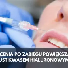 Czego nie wolno robić po wstrzyknięciu kwasu hialuronowego, aby uniknąć problemów?