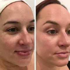 Gdzie kupić deep phyto peeling? Sprawdź najlepsze opcje i ceny