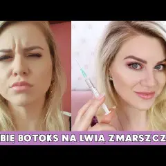Kiedy botox zaczyna działać? Oczekuj efektów już po kilku dniach