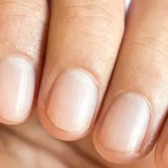 Co oznaczają bruzdy na paznokciach i kiedy powinny niepokoić?