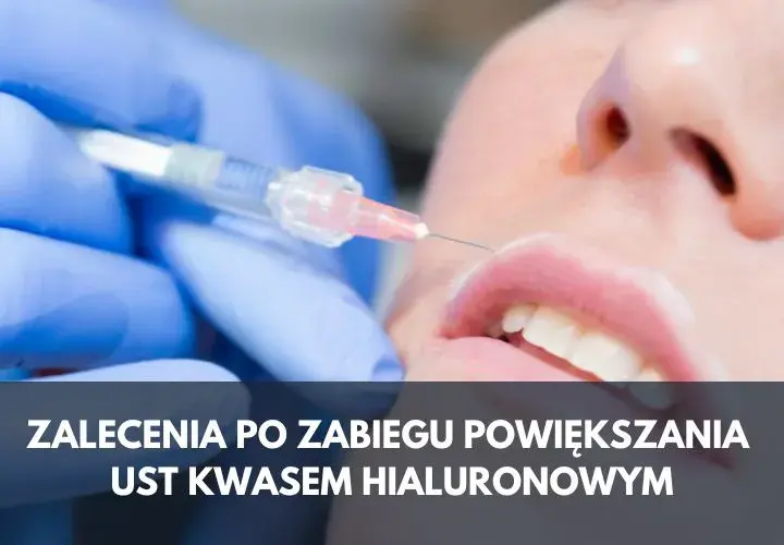 Czego nie wolno robić po wstrzyknięciu kwasu hialuronowego, aby uniknąć problemów?