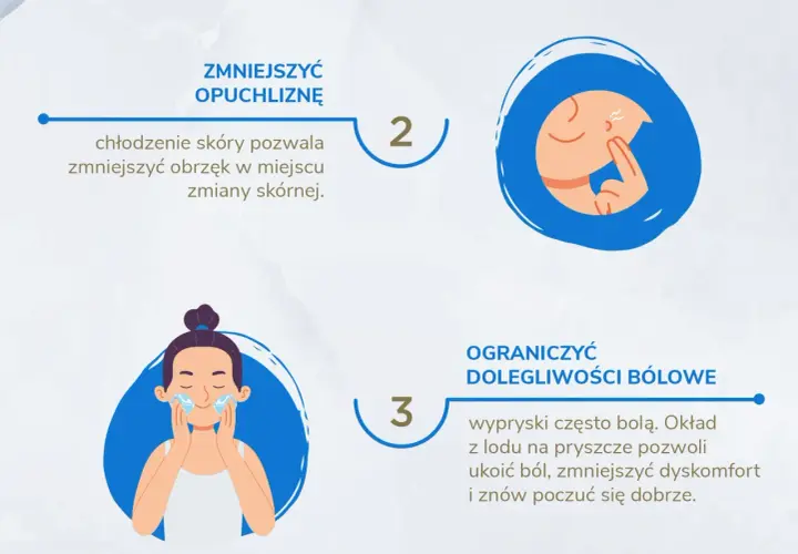 Czy lód pomaga na pryszcze? Poznaj skuteczne metody łagodzenia trądziku