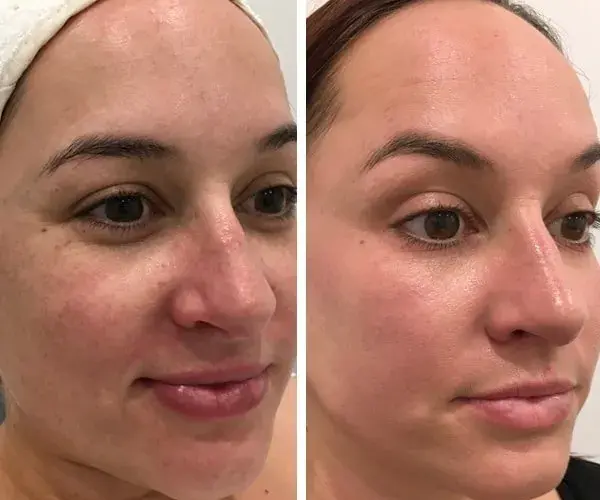 Gdzie kupić deep phyto peeling? Sprawdź najlepsze opcje i ceny