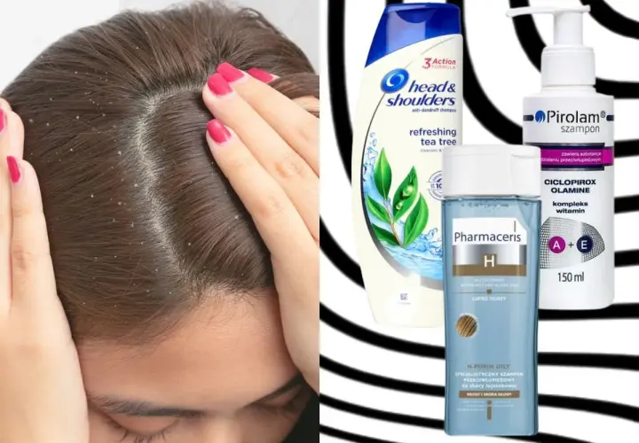 Szukasz skutecznego szamponu przeciwłupieżowego? Sprawdź pirolam opinie i porównaj z Head & Shoulders i Pharmaceris.