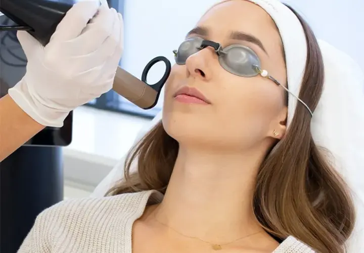 Laser frakcyjny czy mezoterapia - co wybrać dla zdrowej skóry?