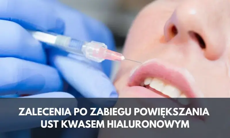 Czego nie wolno robić po wstrzyknięciu kwasu hialuronowego, aby uniknąć problemów?