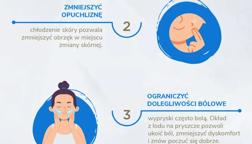 Czy lód pomaga na pryszcze? Poznaj skuteczne metody łagodzenia trądziku