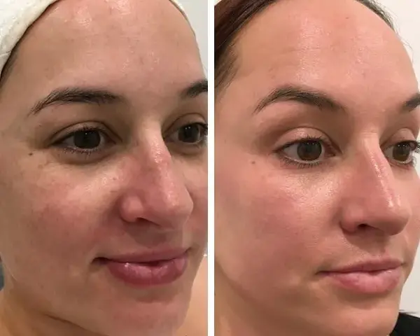 Gdzie kupić deep phyto peeling? Sprawdź najlepsze opcje i ceny