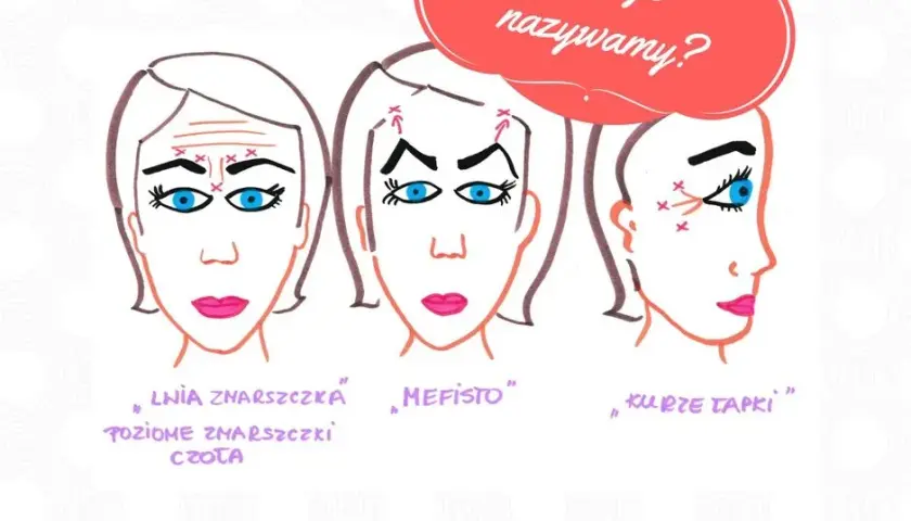 Ile jednostek botoksu na kurze łapki? Sprawdź, co musisz wiedzieć