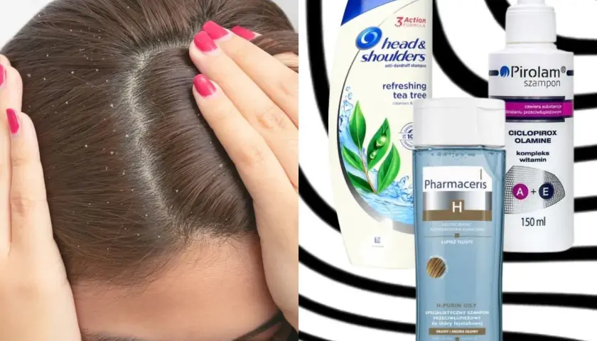 Szukasz skutecznego szamponu przeciwłupieżowego? Sprawdź pirolam opinie i porównaj z Head & Shoulders i Pharmaceris.