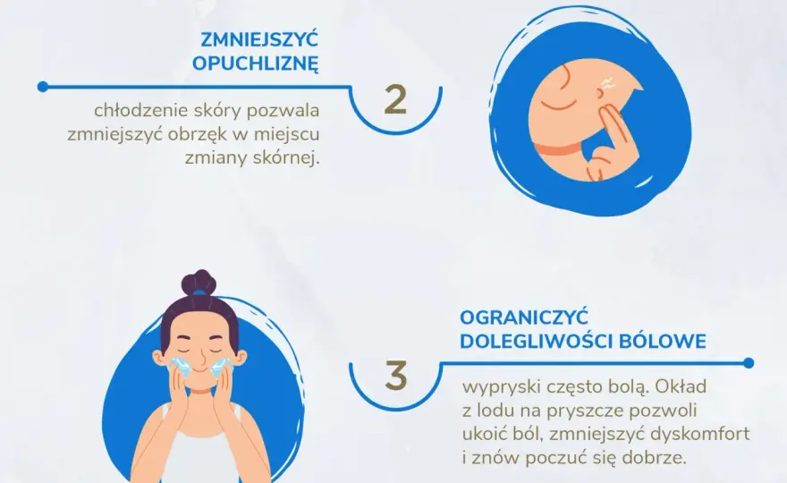 Czy lód pomaga na pryszcze? Poznaj skuteczne metody łagodzenia trądziku
