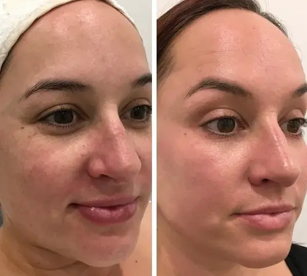 Gdzie kupić deep phyto peeling? Sprawdź najlepsze opcje i ceny