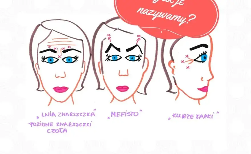 Ile jednostek botoksu na kurze łapki? Sprawdź, co musisz wiedzieć