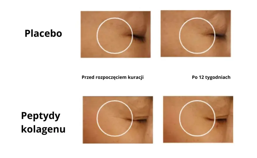 Kolagen do picia Dr. Max - Opinie, skład i efekty. Czy warto?