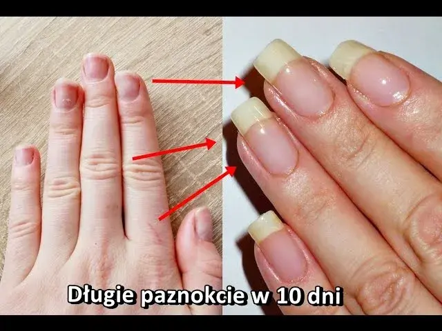 Jak zapuścić szybko paznokcie - skuteczne metody na długie i mocne paznokcie