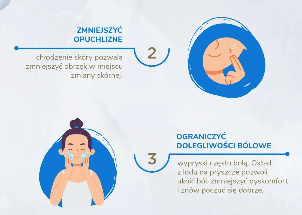 Czy lód pomaga na pryszcze? Poznaj skuteczne metody łagodzenia trądziku