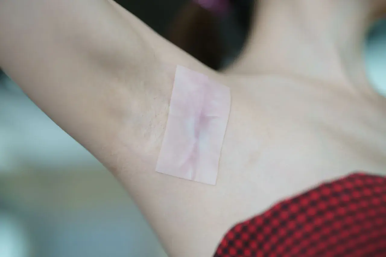 Plaster na bliznę po depilacji. Czy silaurum opinie potwierdzają jego skuteczność?