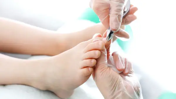 Zabieg podologiczny: pielęgnacja stóp, usuwanie wrastającego paznokcia. Tribiotic na wrastający paznokieć pomoże w leczeniu.